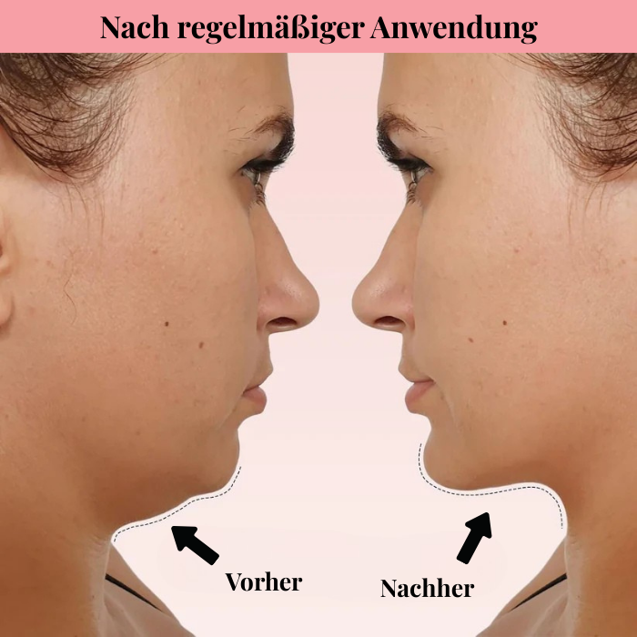 Feybel V-Line Maske - Für definierte Gesichtszüge