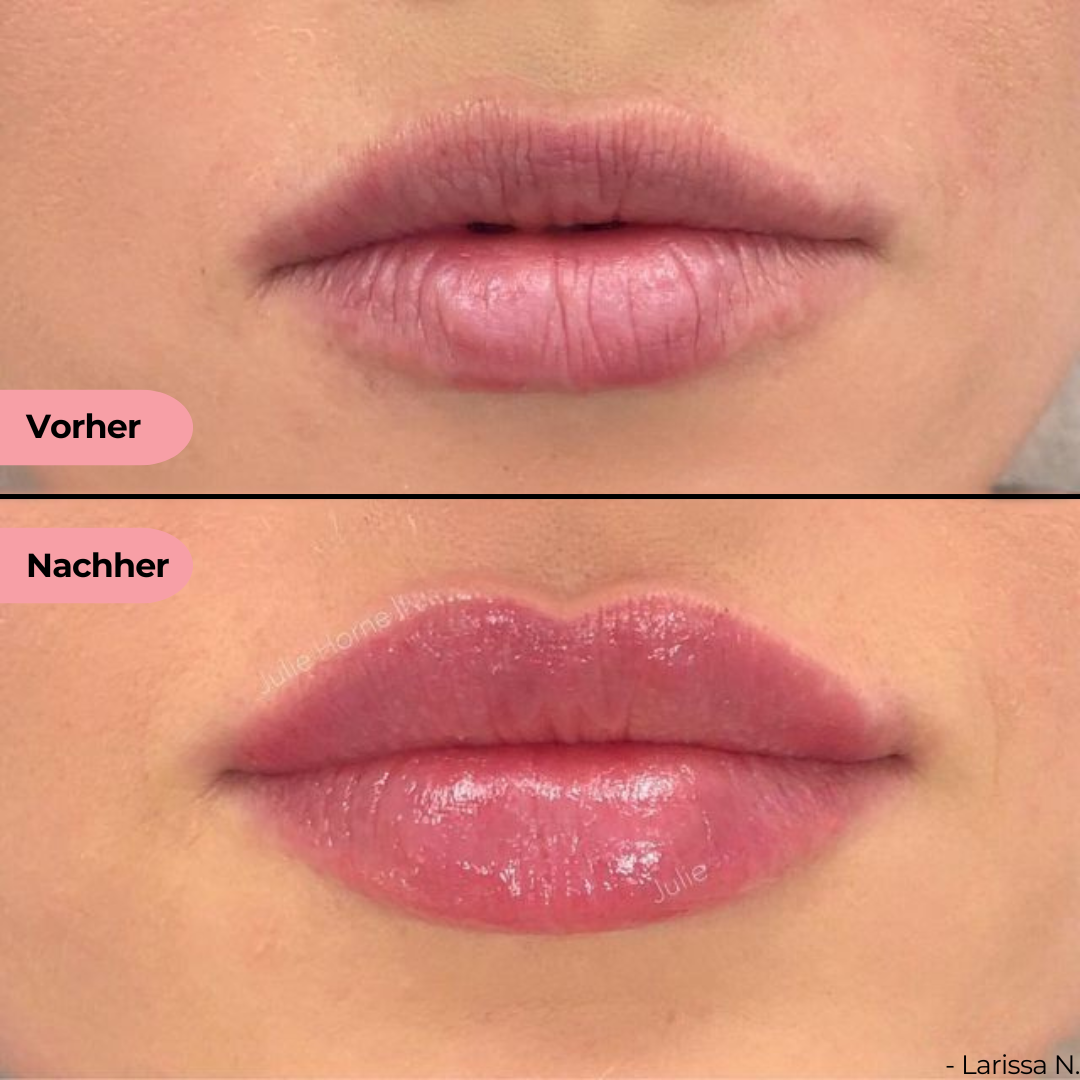 PeelContour Ink™ - Lipliner Tattoo